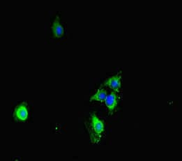CDS1 Antibody