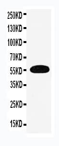 SLC1A1 / EAAT3 Antibody (aa10-27)