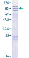 Human SPRTN / C1orf124 Protein (Recombinant GST)