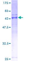 Human ARMC1 Protein (Recombinant GST)