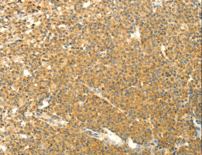 Polyclonal Rabbit anti-Human AARS2 Antibody (IHC, WB)