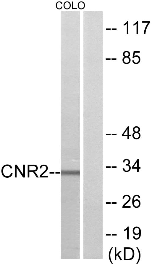 IHC-plus™ CNR2 / CB2 Antibody (aa191-240)