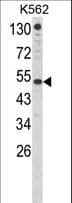 Polyclonal Rabbit anti-Human IFNAR1 / IFNAR Antibody (aa162-188, IHC, WB)