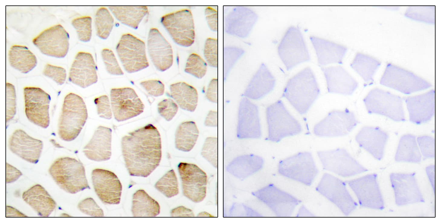 MAPKAPK3 Antibody (aa301-350)