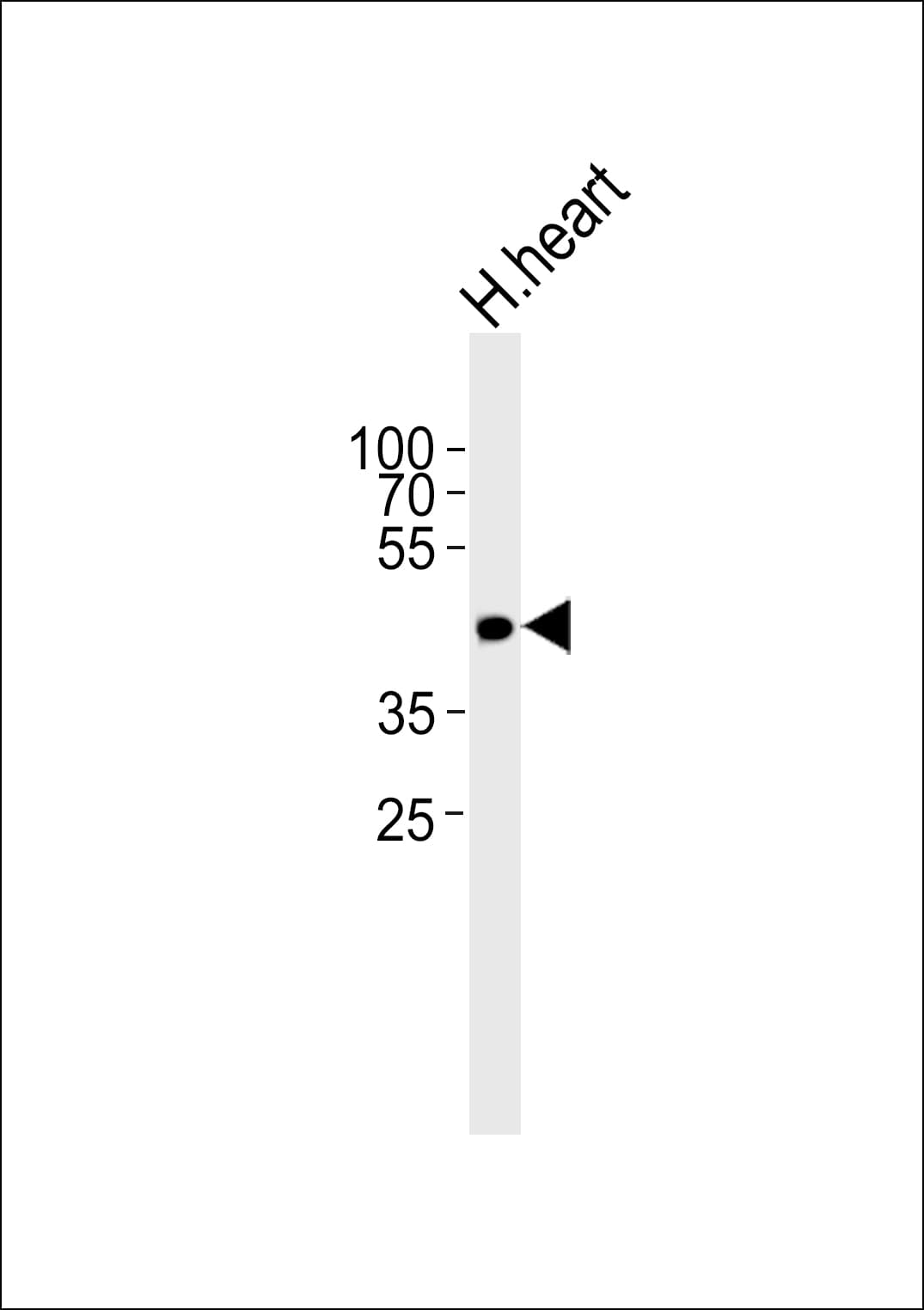 Polyclonal Rabbit anti-Human OR13C9 Antibody (aa13-44, WB)