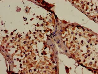 SLC16A7 / MCT2 Antibody