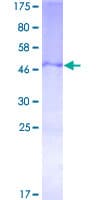 Human TFPI2 Protein (Recombinant GST)