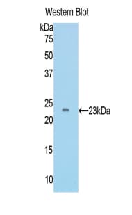 TIMP4 Antibody (aa42-224)