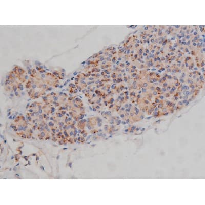 SYN / FYN Antibody (phospho-Tyr530)