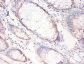 FASN / Fatty Acid Synthase Antibody (aa2155-2495)