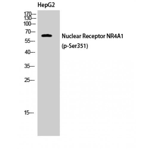 Polyclonal Rabbit anti-Human NR4A1 / NUR77 Antibody (phospho-Ser351, IHC, WB)