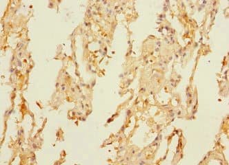 DUSP16 / MKP7 Antibody
