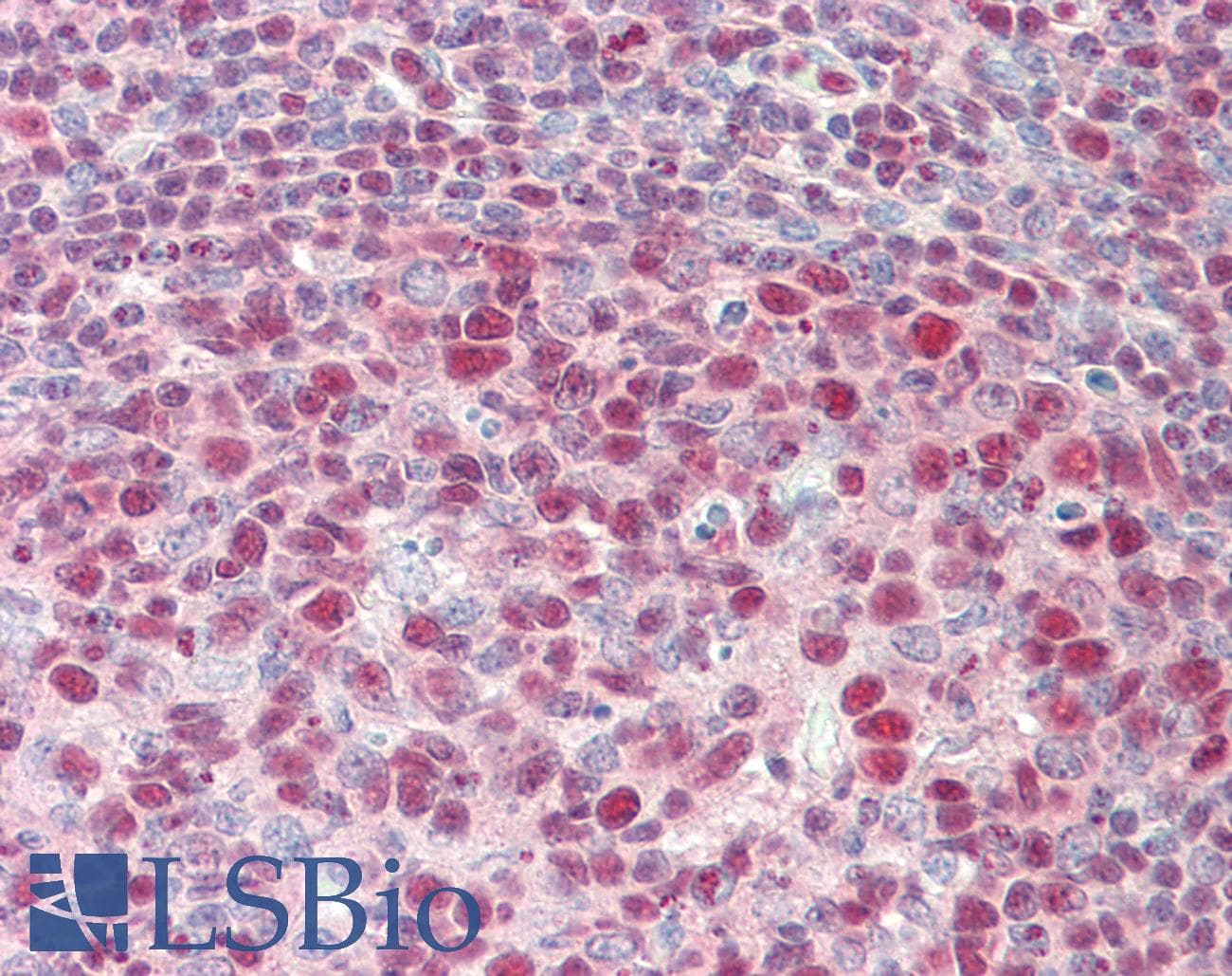 IHC-plus™ Polyclonal Rabbit anti-Human XPO1 / CRM1 Antibody (aa1025-C-term, IHC, WB)