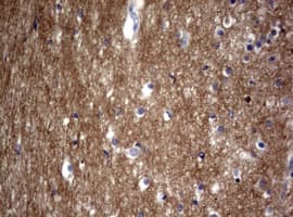VILIP / VSNL1 Antibody (aa2-191, clone OTI1C8, Carrier-free)