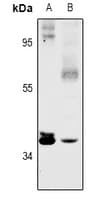 SFXN4 Antibody