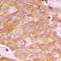 BEGAIN Antibody (C-Terminus)