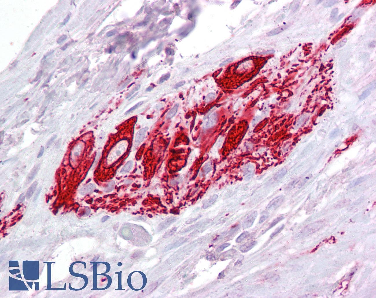 IHC-plus™ ABRI / ITM2B Antibody (aa224-238)