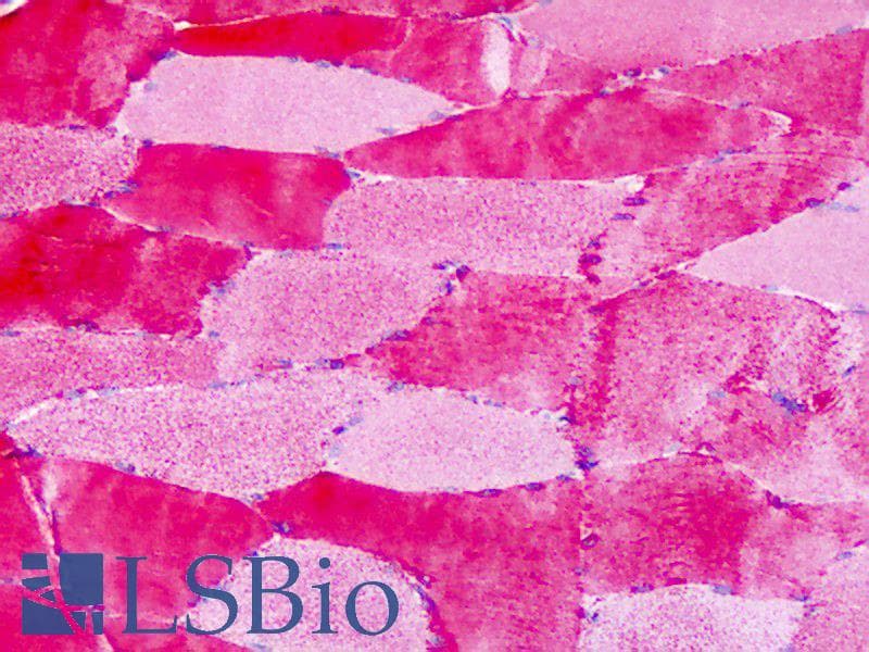 PathPlus™ Polyclonal Rabbit anti-Human GPER1 / GPR30 Antibody (Extracellular Domain, IHC)