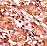 BAD Antibody (phospho-Ser134)