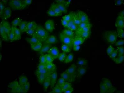 FBXO10 Antibody
