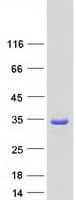 Human TPD52L2 / HD54 Protein (Recombinant Myc-DDK (Flag))