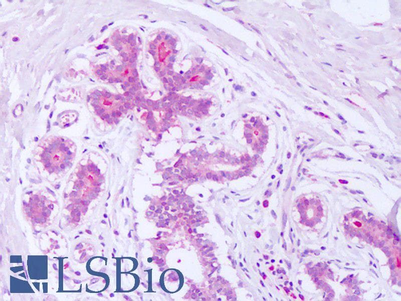 IHC-plus™ SDCBP / Syntenin Antibody (aa6-19)