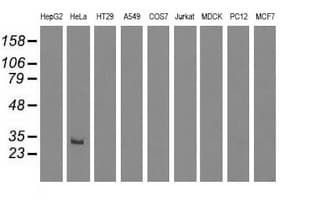 GSTT2 Antibody (clone OTI7A12)