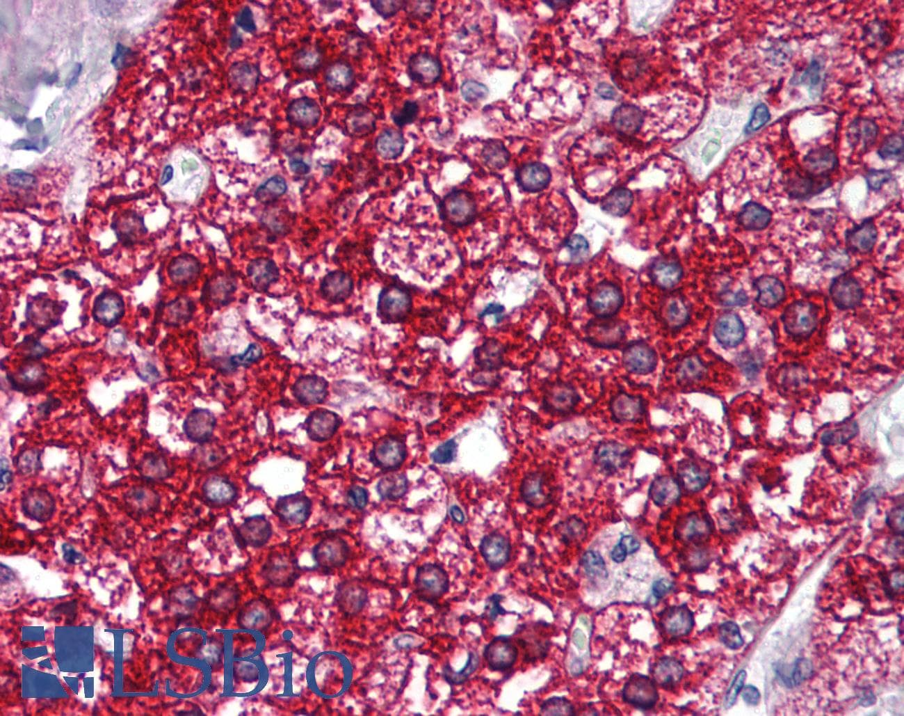 IHC-plus™ SOAT1 Antibody (aa6-23)