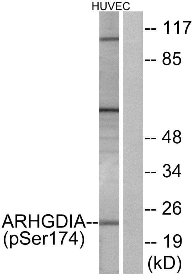ARHGDIA / RHOGDI Antibody (phospho-Ser174)