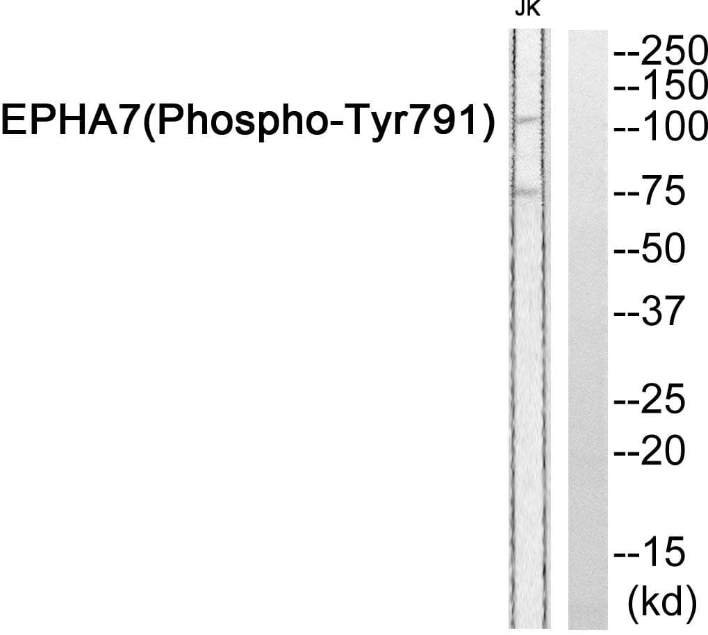 EPHA7 / EPH Receptor A7 Antibody (phospho-Tyr791)