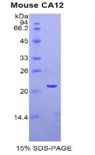 Mouse CA12 / Carbonic Anhydrase XII Protein (Recombinant His)