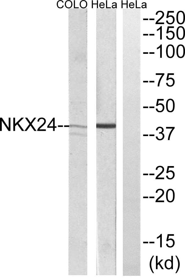 Polyclonal Rabbit anti-Human NKX2-4 Antibody (WB)