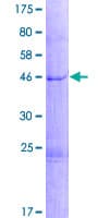 Human PIP5KL1 Protein (Recombinant GST)