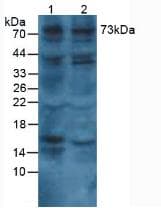 COL8A1 / Collagen VIII Alpha 1 Antibody (aa575-743, APC)