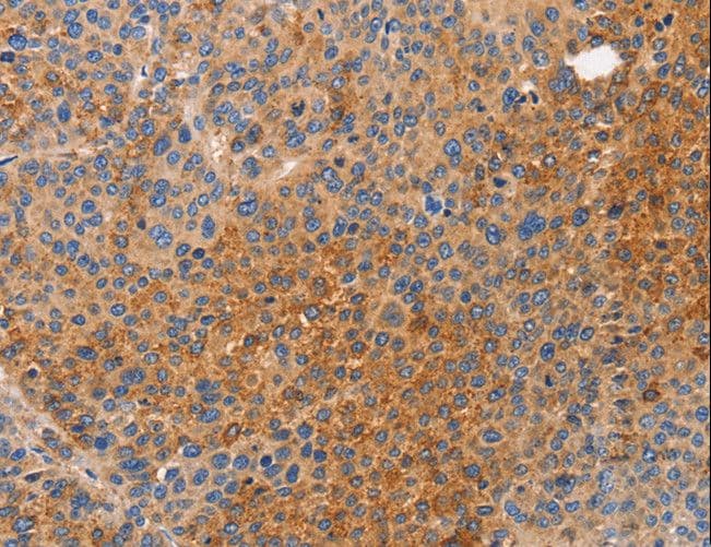 Polyclonal Rabbit anti-Human NOD1 Antibody (IHC)