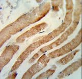 Polyclonal Rabbit anti-Human RAB7A / RAB7 Antibody (aa176-204, IHC, WB)