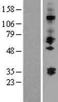 ST3GAL2 Protein (Over-Expression Lysate Myc-DDK (Flag))