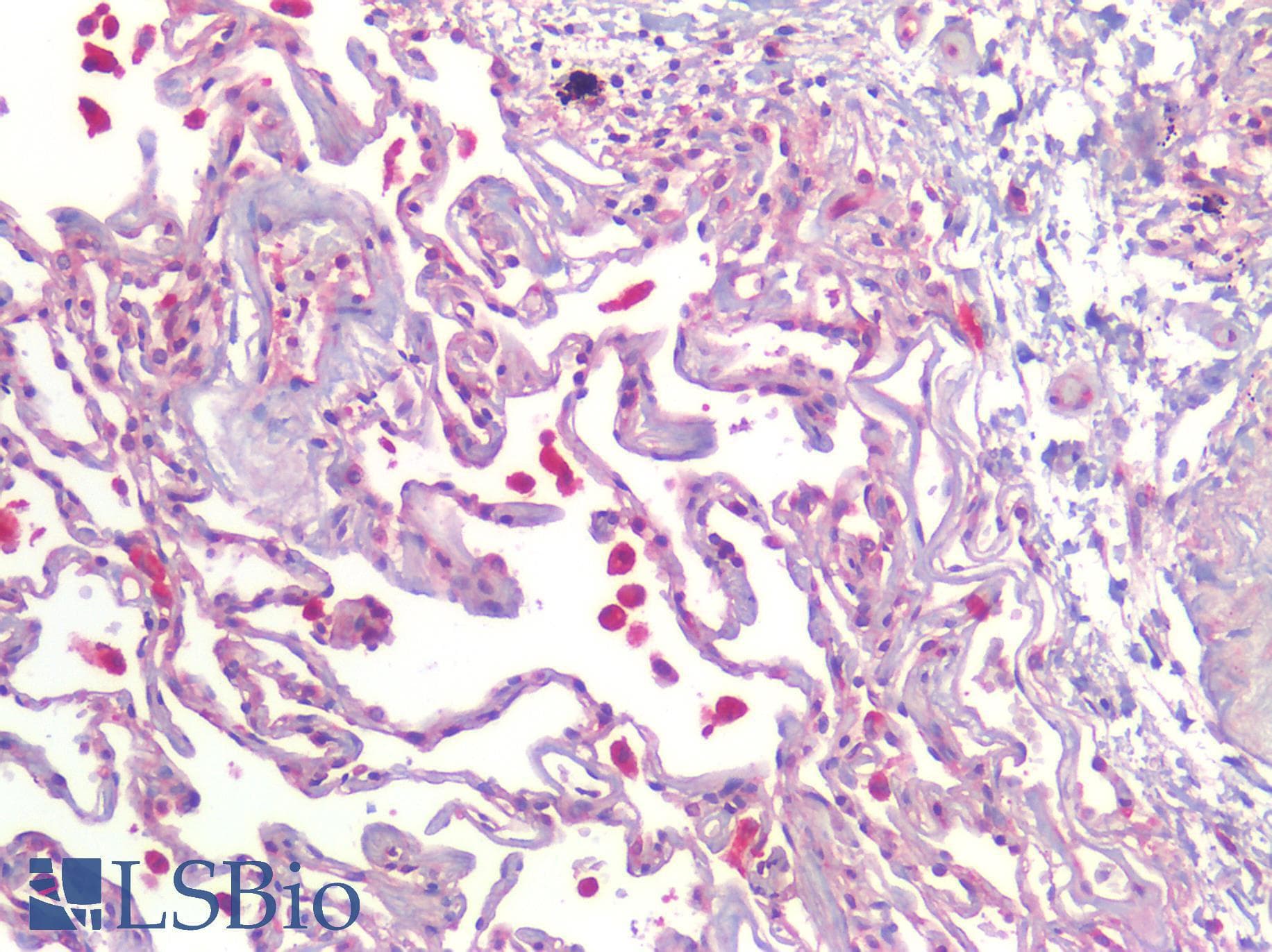 PathPlus™ CALCRL / CGRP Receptor Antibody (Cytoplasmic Domain)