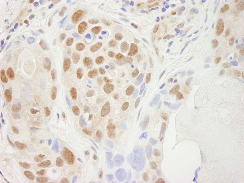 Polyclonal Rabbit anti-Human SPT5 / SUPT5H Antibody (aa1040-C-term, IHC)