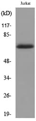 KRT2 / CK2 / Cytokeratin 2 Antibody