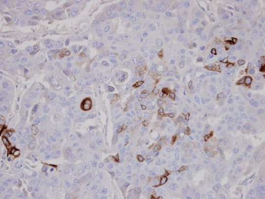 Polyclonal Rabbit anti-Human AKAP10 Antibody (aa600-662, IHC)