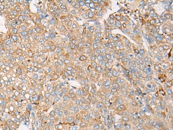 Polyclonal Rabbit anti-Human CAPN9 / Calpain 9 Antibody (IHC)