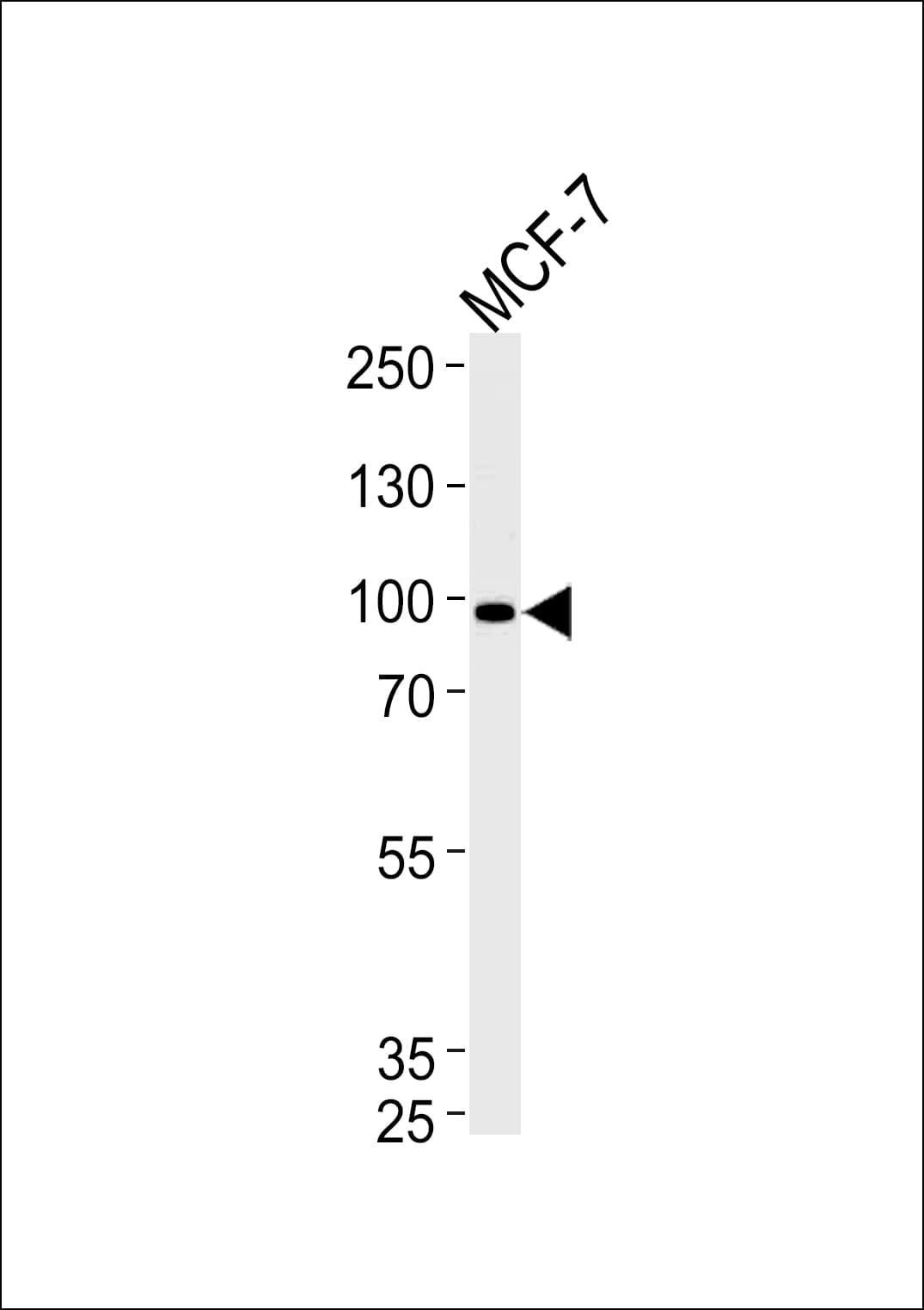 COL9A1 / Collagen IX Antibody (aa428-456)