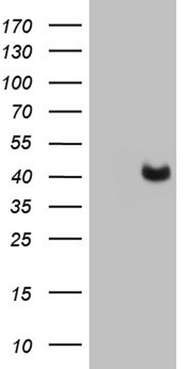 PAGE1 Antibody (clone OTI3E7)