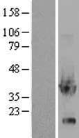 GPD1 Protein (Over-Expression Lysate Myc-DDK (Flag))