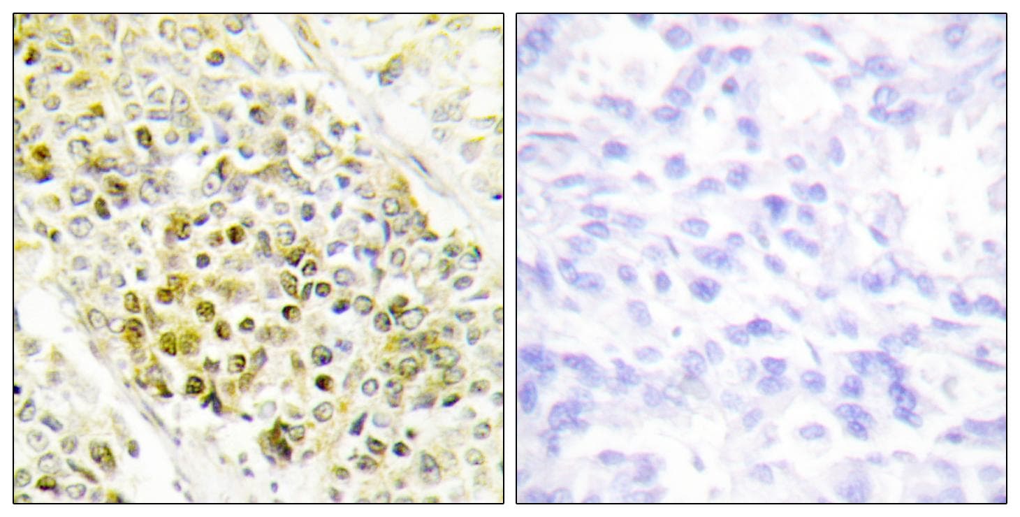 Polyclonal Rabbit anti-Human DLX5 Antibody (IHC, WB)