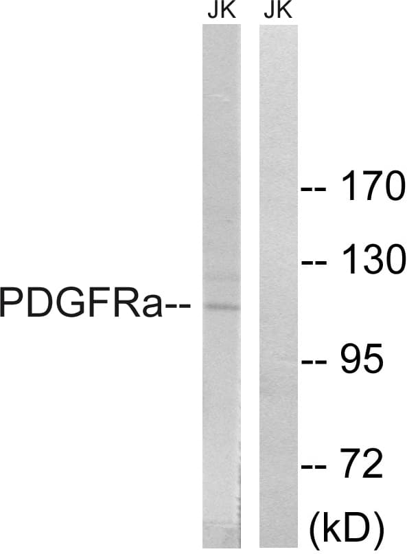 PDGFRA / PDGFR Alpha Antibody (aa816-865)