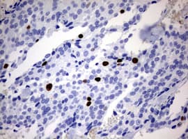 MKI67 / Ki67 Antibody (aa1160-1493, clone OTI13F12)