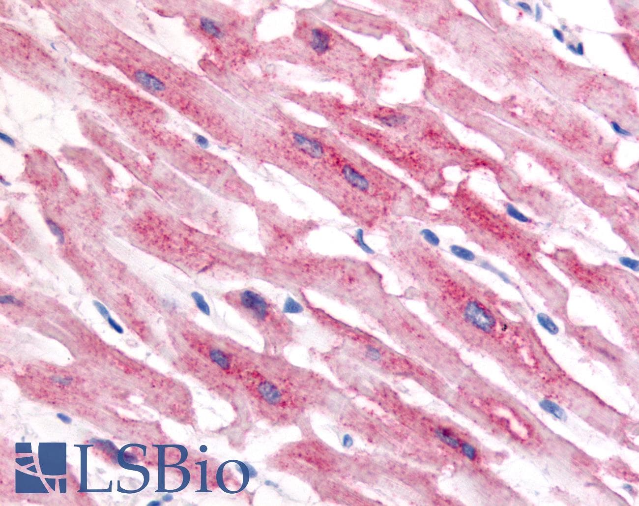 IHC-plus™ HIF2A / EPAS1 Antibody (aa535-631, clone ep190b)