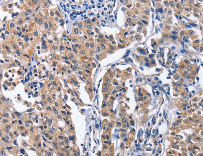INTS10 Antibody